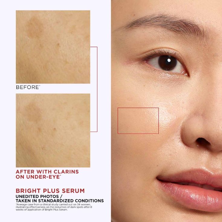 BRIGHT PLUS [ADVANCED] BRIGHTENING DARK SPOT-TARGETING EXPERT SERUM